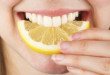 Lấy cao răng răng có trắng không? – Đây chính là sự thật