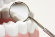 Bọc răng sứ có tốt không? Nhìn rõ mặt lợi, hại của phương pháp