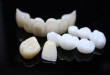 Bật mí những thông tin chi tiết về răng sứ Emax