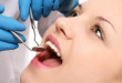 Lấy cao răng hết bao lâu thì xong? Thời gian thực hiện tại nha khoa