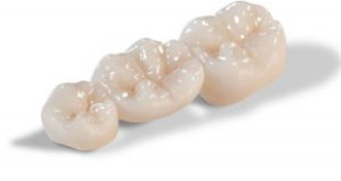 Bọc răng sứ Cercon HT – Những lợi ích thực sự khó bỏ qua
