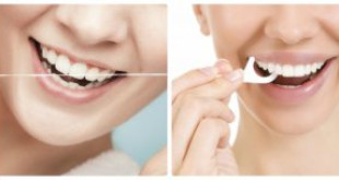 Công dụng của chỉ tơ nha khoa