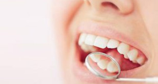 Nên đi lấy cao răng không? Câu trả lời có ngay trong bài viết này