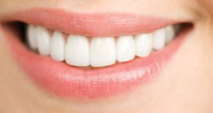 Bất ngờ với hiệu quả lấy cao răng bằng phương pháp tự nhiên