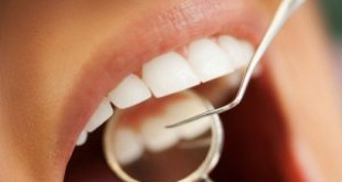 Cách chăm sóc răng sau khi lấy cao răng tuyệt đối đừng nên xem thường