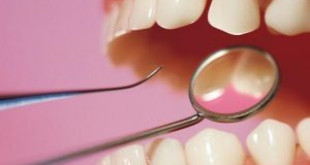 Lấy cao răng có hại gì không? [Bản chất thực sự của lấy cao răng]
