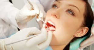 Lấy cao răng định – Sức khỏe răng miệng của bạn sẽ được đảm bảo