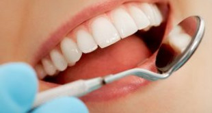 Bọc răng sứ sử dụng được bao lâu? Xem chi tiết tại đây