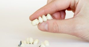 Tìm hiểu ngay nếu bạn còn băn khoăn: Có nên bọc răng sứ không?