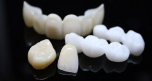 Bật mí những thông tin chi tiết về răng sứ Emax