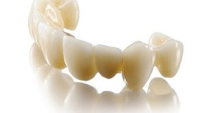 Cùng “mổ xẻ” những vấn đề liên quan đến răng sứ Venus