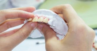 Bọc sứ răng cửa – Giải pháp HOÀN HẢO khắc phục răng cửa xấu nhanh chóng