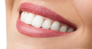 Làm răng ở đâu giúp bạn sở hữu hàm răng đẹp không tỳ vết?