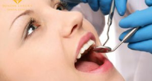 Lấy cao răng sau khi sinh có được không? Nha sĩ tư vấn cho bạn