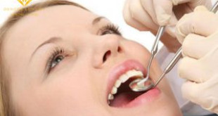 Lấy cao răng siêu âm là gì? – Bác sĩ giải đáp thắc mắc