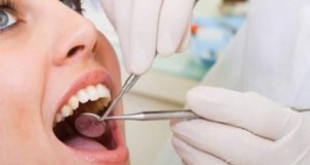 Lấy cao răng ê buốt – Hé lộ những nguyên nhân hàng đầu gây nên