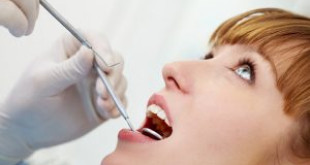 Lấy cao răng tác dụng gì? Tại sao nên thực hiện lấy cao răng 6 tháng 1 lần