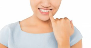 Lưu ý khi đi lấy cao răng nên biết để đảm bảo AN TOÀN & CHẤT LƯỢNG