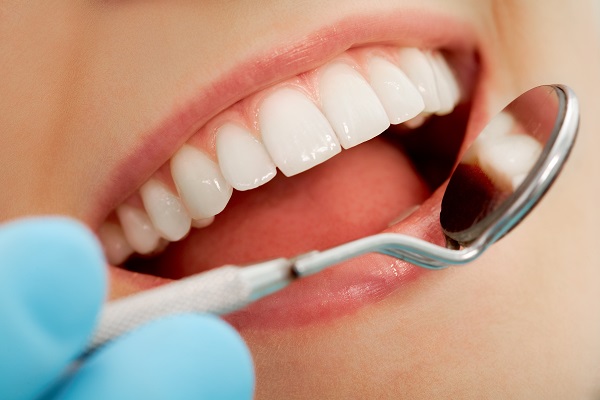 bọc răng sứ sử dụng được bao lâu