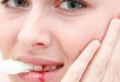 Khẩn cấp: Đánh răng bị chảy máu có phải là bệnh lý nguy hiểm không?