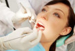 Lấy cao răng định – Sức khỏe răng miệng của bạn sẽ được đảm bảo