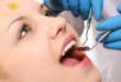 Lấy cao răng sau khi sinh có được không? Nha sĩ tư vấn cho bạn