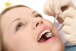 Lấy cao răng siêu âm là gì? – Bác sĩ giải đáp thắc mắc