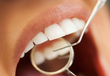 Cách chăm sóc răng sau khi lấy cao răng tuyệt đối đừng nên xem thường